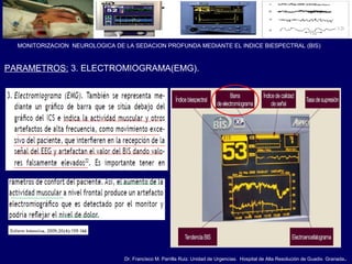 Dr. Francisco M. Parrilla Ruiz. Unidad de Urgencias. Hospital de Alta Resolución de Guadix. Granada.
MONITORIZACION NEUROLOGICA DE LA SEDACION PROFUNDA MEDIANTE EL INDICE BIESPECTRAL (BIS)
PARAMETROS: 3. ELECTROMIOGRAMA(EMG).
 