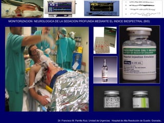 Dr. Francisco M. Parrilla Ruiz. Unidad de Urgencias. Hospital de Alta Resolución de Guadix. Granada.
MONITORIZACION NEUROLOGICA DE LA SEDACION PROFUNDA MEDIANTE EL INDICE BIESPECTRAL (BIS)
 