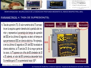 Dr. Francisco M. Parrilla Ruiz. Unidad de Urgencias. Hospital de Alta Resolución de Guadix. Granada.
MONITORIZACION NEUROLOGICA DE LA SEDACION PROFUNDA MEDIANTE EL INDICE BIESPECTRAL (BIS)
PARAMETROS: 4. TASA DE SUPRESION(TS).
TS
100
BIS
0
 