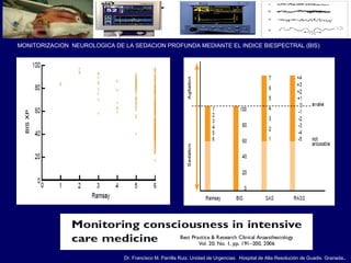 Dr. Francisco M. Parrilla Ruiz. Unidad de Urgencias. Hospital de Alta Resolución de Guadix. Granada.
MONITORIZACION NEUROLOGICA DE LA SEDACION PROFUNDA MEDIANTE EL INDICE BIESPECTRAL (BIS)
 