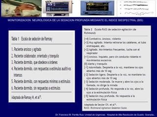Dr. Francisco M. Parrilla Ruiz. Unidad de Urgencias. Hospital de Alta Resolución de Guadix. Granada.
MONITORIZACION NEUROLOGICA DE LA SEDACION PROFUNDA MEDIANTE EL INDICE BIESPECTRAL (BIS)
 