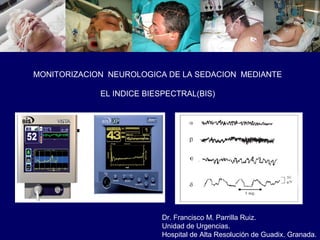 Dr. Francisco M. Parrilla Ruiz.
Unidad de Urgencias.
Hospital de Alta Resolución de Guadix. Granada.
MONITORIZACION NEUROLOGICA DE LA SEDACION MEDIANTE
EL INDICE BIESPECTRAL(BIS)
 
