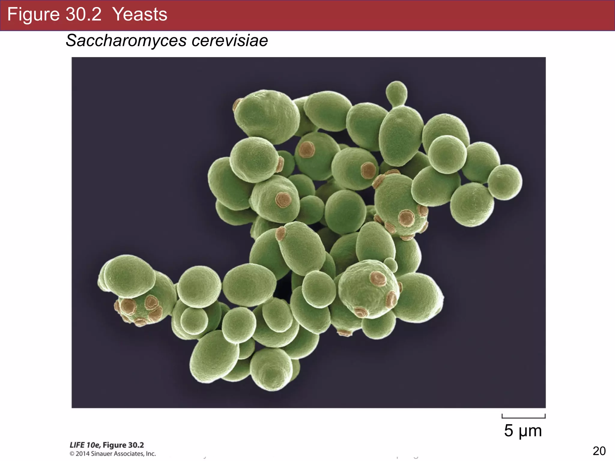 Figure 30.2 Yeasts
!20Slides by Jonathan Eisen for BIS2C at UC Davis Spring 2016
Saccharomyces cerevisiae
5 µm
 