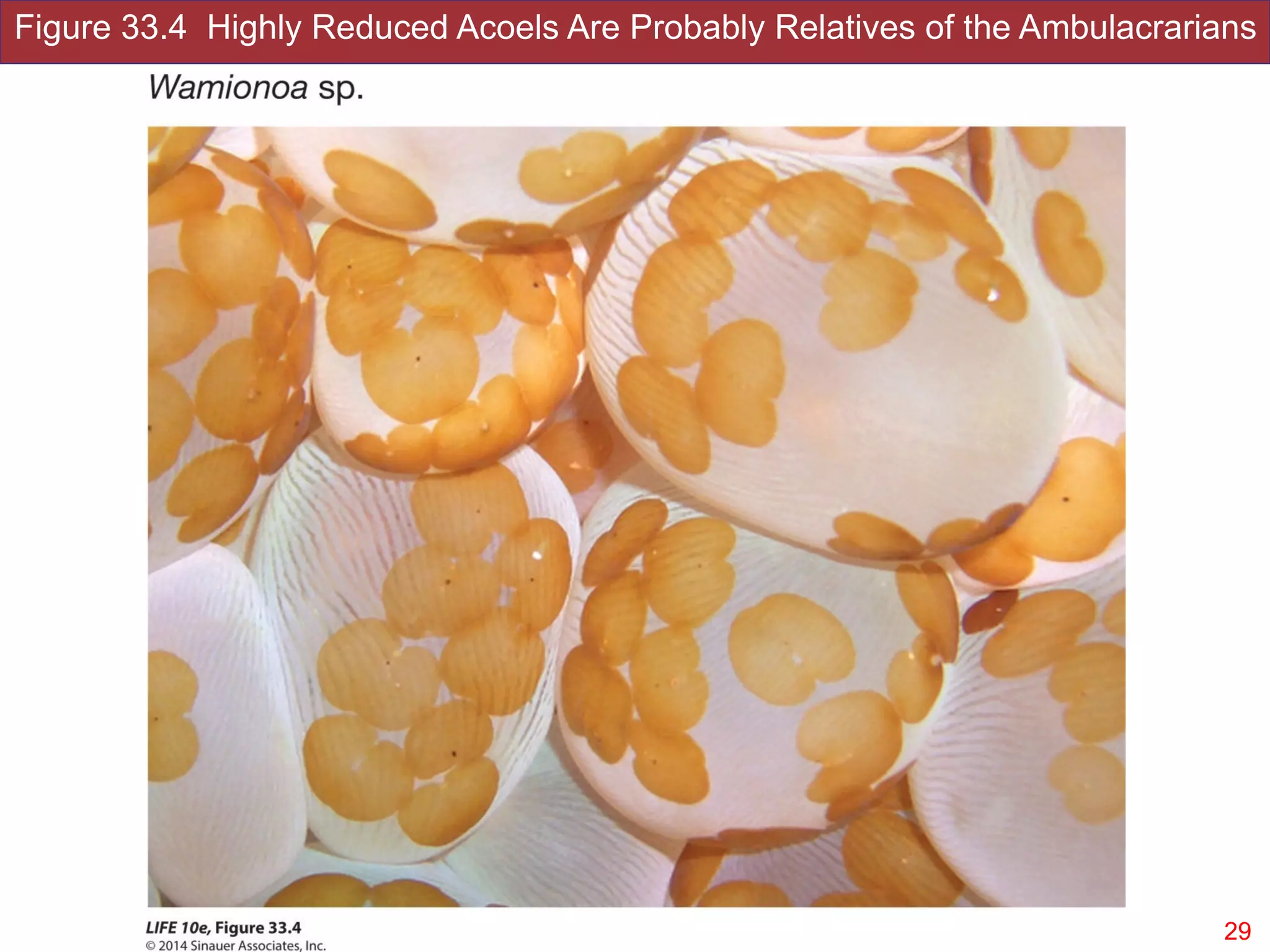 Figure 33.4 Highly Reduced Acoels Are Probably Relatives of the Ambulacrarians
!29Slides by Jonathan Eisen for BIS2C at UC Davis Spring 2016
 