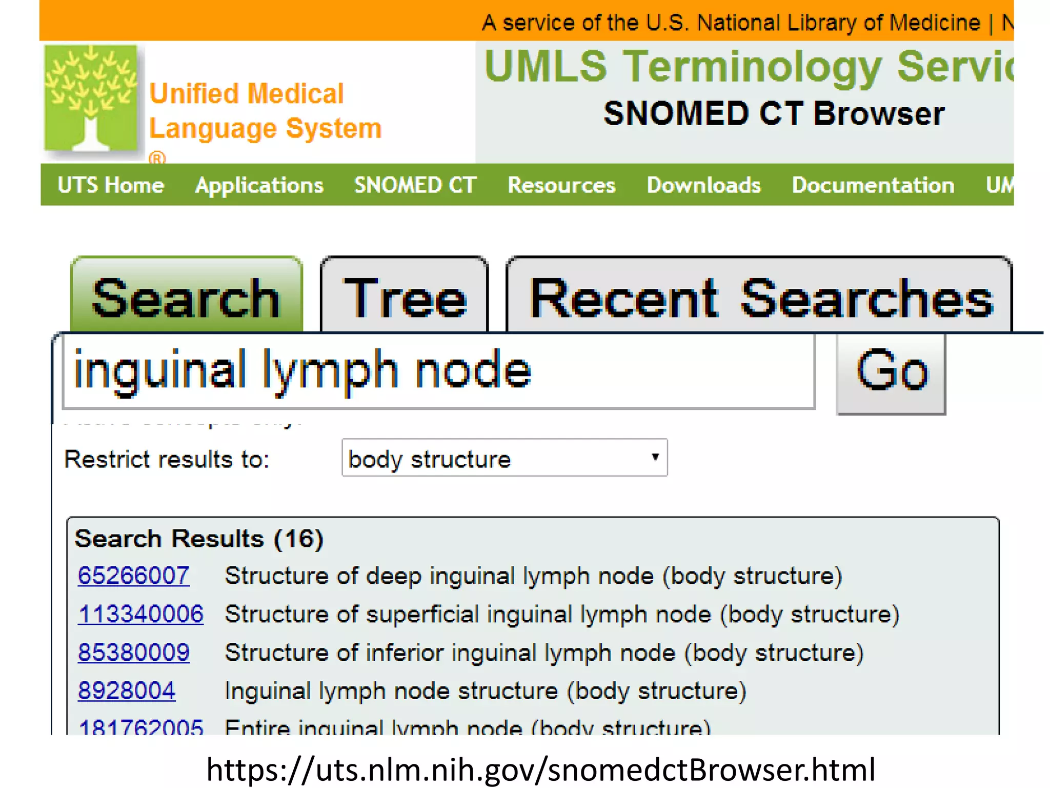 https://uts.nlm.nih.gov/snomedctBrowser.html

 