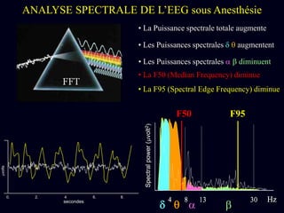 • La F50 (Median Frequency) diminue
Spectralpower(mvolt2)
4 8 13 30 Hz
• La F95 (Spectral Edge Frequency) diminue
d a b
0. 2. 4 6. 8.
secondes
mvolts
Spectralpower(mvolt2)
4 8 13 30 Hz
• La Puissance spectrale totale augmente
• Les Puissances spectrales d  augmentent
• Les Puissances spectrales a b diminuent
F50 F95
ANALYSE SPECTRALE DE L’EEG sous Anesthésie
 