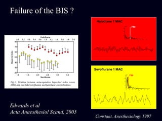 Constant, Anesthesiology 1997
100
200
300
0 5 10 15 20 25 30 35
Hz
mv2
F50
Halothane 1 MAC
100
200
300
0 5 10 15 20 25 30 35
Hz
Sevoflurane 1 MAC
mv2
F50
Failure of the BIS ?
Edwards et al
Acta Anaesthesiol Scand, 2005
 