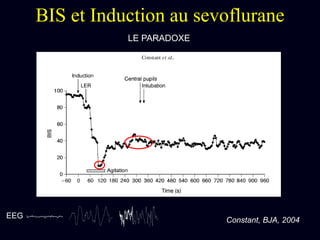 BIS et Induction au sevoflurane
Constant, BJA, 2004
LE PARADOXE
EEG
 