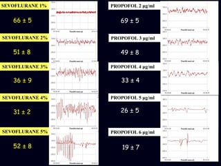 SEVOFLURANE 1%
SEVOFLURANE 2%
SEVOFLURANE 3%
SEVOFLURANE 4%
SEVOFLURANE 5%
PROPOFOL 2 μg/ml
PROPOFOL 3 μg/ml
PROPOFOL 4 μg/ml
PROPOFOL 5 μg/ml
PROPOFOL 6 μg/ml
66 ± 5 69 ± 5
51 ± 8 49 ± 8
36 ± 9 33 ± 4
31 ± 2 26 ± 5
19 ± 752 ± 8
 