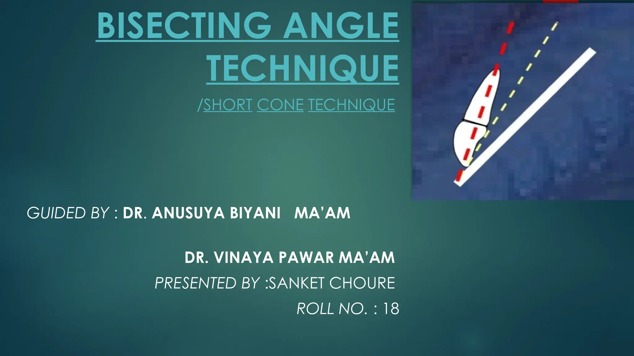 Bisecting Angle Technique Radiology PPT | PPTX
