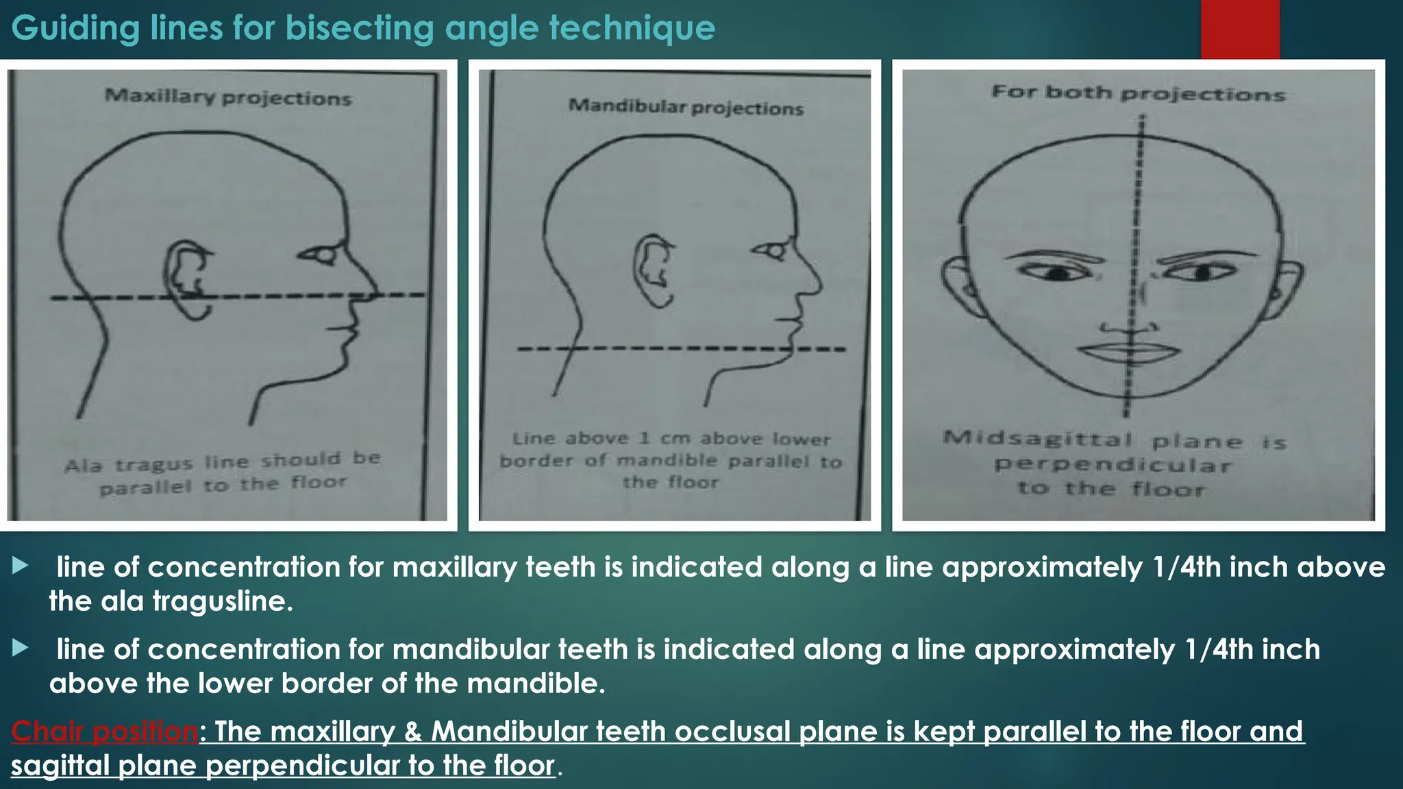 Bisecting Angle Technique Radiology PPT | PPTX