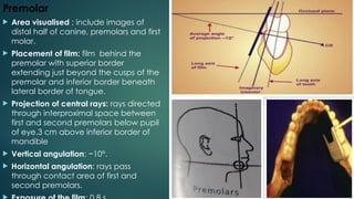 Tooth Bisection Bisecting Angle Technique Radiology PPT | PPTX