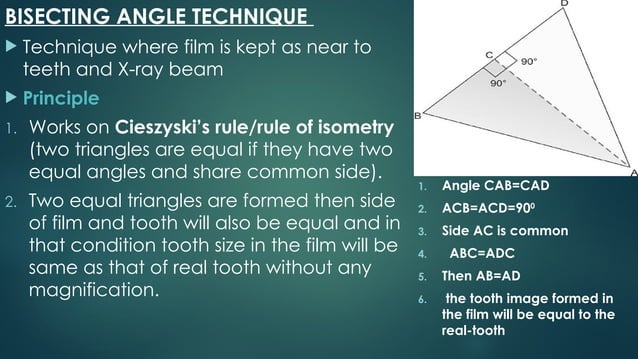 Bisecting Angle Technique Radiology PPT | PPTX
