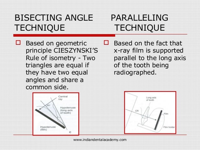 paralleling technique