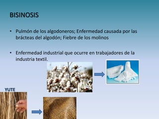 BISINOSIS

 • Pulmón de los algodoneros; Enfermedad causada por las
   brácteas del algodón; Fiebre de los molinos

 • Enfermedad industrial que ocurre en trabajadores de la
   industria textil.




YUTE
 