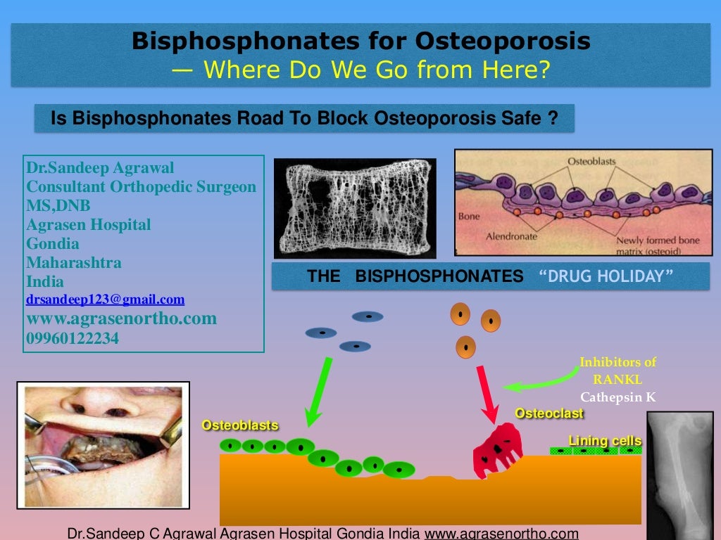 Bisphosphonates for osteoporosis where do we go from here? is bispho…