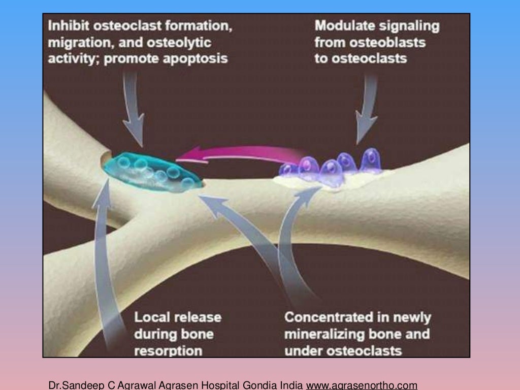 Bisphosphonates for osteoporosis where do we go from here? is bispho…