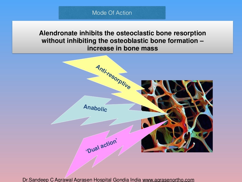 Bisphosphonates for osteoporosis where do we go from here? is bispho…