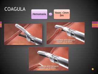 COAGULA
Hemostasia
Vasos >3mm
Dm
 