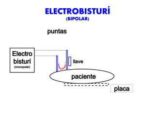 ELECTROBISTURÍ
(BIPOLAR)
puntas
Electro
bisturí
(monopolar)
placa
paciente
llave
 