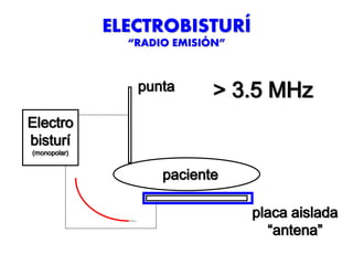 ELECTROBISTURÍ
“RADIO EMISIÓN”
punta
Electro
bisturí
(monopolar)
placa aislada
“antena”
paciente
> 3.5 MHz
 