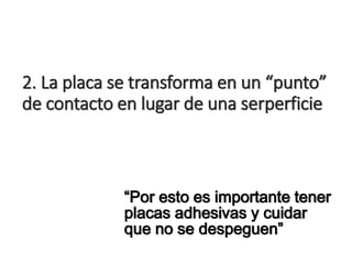 2. La placa se transforma en un “punto”
de contacto en lugar de una serperficie
“Por esto es importante tener
placas adhesivas y cuidar
que no se despeguen”
 