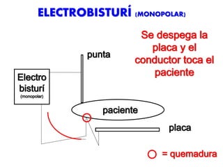 ELECTROBISTURÍ (MONOPOLAR)
punta
Electro
bisturí
(monopolar)
placa
paciente
= quemadura
Se despega la
placa y el
conductor toca el
paciente
 