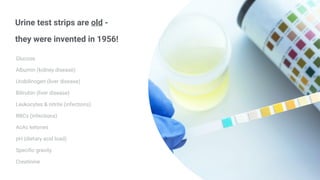 Urine test strips are old -
they were invented in 1956!
Glucose
Albumin (kidney disease)
Urobilinogen (liver disease)
Bilirubin (liver disease)
Leukocytes & nitrite (infections)
RBCs (infections)
AcAc ketones
pH (dietary acid load)
Speciﬁc gravity
Creatinine
 