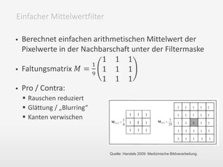  Berechnet einfachen arithmetischen Mittelwert der
Pixelwerte in der Nachbarschaft unter der Filtermaske
 Faltungsmatrix 𝑀 =
1
9
1 1 1
1 1 1
1 1 1
 Pro / Contra:
 Rauschen reduziert
 Glättung / „Blurring“
 Kanten verwischen
Einfacher Mittelwertfilter
Quelle: Handels 2009: Medizinische Bildverarbeitung.
 