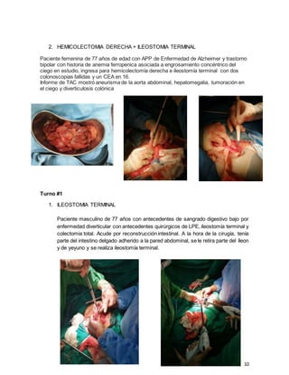 10
2. HEMICOLECTOMIA DERECHA + ILEOSTOMIA TERMINAL
Paciente femenina de 77 años de edad con APP de Enfermedad de Alzheimer y trastorno
bipolar con historia de anemia ferropenica asociada a engrosamiento concéntrico del
ciego en estudio, ingresa para hemicolectomía derecha e ileostomía terminal con dos
colonoscopias fallidas y un CEA en 16.
Informe de TAC mostró aneurisma de la aorta abdominal, hepatomegalia, tumoración en
el ciego y diverticulosis colónica
Turno #1
1. ILEOSTOMIA TERMINAL
Paciente masculino de 77 años con antecedentes de sangrado digestivo bajo por
enfermedad diverticular con antecedentes quirúrgicos de LPE, ileostomía terminal y
colectomia total. Acude por reconstrucción intestinal. A la hora de la cirugía, tenía
parte del intestino delgado adherido a la pared abdominal, se le retira parte del íleon
y de yeyuno y se realiza ileostomía terminal.
 
