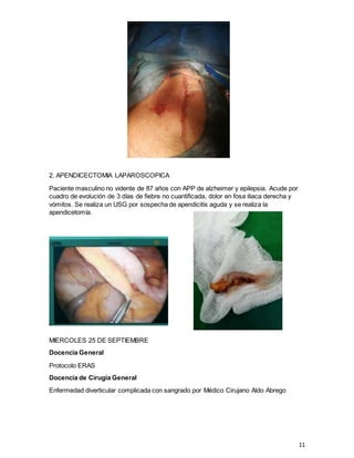 11
2. APENDICECTOMIA LAPAROSCOPICA
Paciente masculino no vidente de 87 años con APP de alzheimer y epilepsia. Acude por
cuadro de evolución de 3 días de fiebre no cuantificada, dolor en fosa iliaca derecha y
vómitos. Se realiza un USG por sospecha de apendicitis aguda y se realiza la
apendicetomía.
MIERCOLES 25 DE SEPTIEMBRE
Docencia General
Protocolo ERAS
Docencia de Cirugía General
Enfermedad diverticular complicada con sangrado por Médico Cirujano Aldo Abrego
 