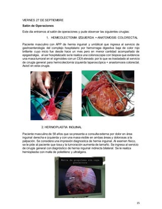 15
VIERNES 27 DE SEPTIEMBRE
Salón de Operaciones
Este día entramos al salón de operaciones y pude observar las siguientes cirugías:
1. HEMICOLECTOMIA IZQUIERDA + ANATOMOSIS COLORECTAL
Paciente masculino con APP de hernia inguinal y umbilical que ingresa al servicio de
gastroenterología del complejo hospitalario por hemorragia digestiva baja de color rojo
brillante cuyo inicio fue desde hace un mes pero en menor cantidad acompañado de
epigastralgia, al ser hospitalizado se le realiza una colonoscopia con biopsia que evidencia
una masa tumoral en el sigmoides con un CEA elevado por lo que es trasladado al servicio
de cirugía general para hemicolectomía izquierda laparoscópica + anastomosis colorectal.
Asistí en esta cirugía.
2. HERNIOPLASTIA INGUINAL
Paciente masculino de 58 años que se presenta a consulta externa por dolor en área
inguinal derecha e izquierda y con una masa visible en ambas áreas y dolorosas a la
palpación. Se considera una impresión diagnostica de hernia inguinal. Al examen físico,
se le pide al paciente que tosa y la tumoración aumenta de tamaño. Se ingresa al servicio
de cirugía general con diagnóstico de hernia inguinal indirecta bilateral. Se le realiza
hernioplastia con malla de polietileno y ultraligera.
 