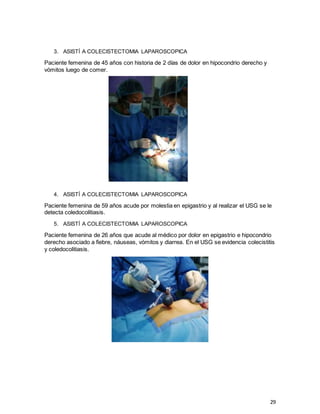29
3. ASISTÍ A COLECISTECTOMIA LAPAROSCOPICA
Paciente femenina de 45 años con historia de 2 días de dolor en hipocondrio derecho y
vómitos luego de comer.
4. ASISTÍ A COLECISTECTOMIA LAPAROSCOPICA
Paciente femenina de 59 años acude por molestia en epigastrio y al realizar el USG se le
detecta coledocolitiasis.
5. ASISTÍ A COLECISTECTOMIA LAPAROSCOPICA
Paciente femenina de 26 años que acude al médico por dolor en epigastrio e hipocondrio
derecho asociado a fiebre, náuseas, vómitos y diarrea. En el USG se evidencia colecistitis
y coledocolitiasis.
 