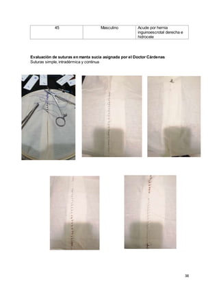 38
Evaluación de suturas en manta sucia asignada por el Doctor Cárdenas
Suturas simple, intradérmica y continua
45 Masculino Acude por hernia
inguinoescrotal derecha e
hidrocele
 