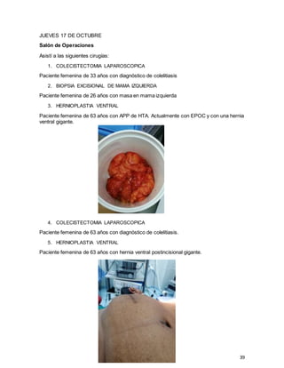 39
JUEVES 17 DE OCTUBRE
Salón de Operaciones
Asistí a las siguientes cirugías:
1. COLECISTECTOMIA LAPAROSCOPICA
Paciente femenina de 33 años con diagnóstico de colelitiasis
2. BIOPSIA EXCISIONAL DE MAMA IZQUIERDA
Paciente femenina de 26 años con masa en mama izquierda
3. HERNIOPLASTIA VENTRAL
Paciente femenina de 63 años con APP de HTA. Actualmente con EPOC y con una hernia
ventral gigante.
4. COLECISTECTOMIA LAPAROSCOPICA
Paciente femenina de 63 años con diagnóstico de colelitiasis.
5. HERNIOPLASTIA VENTRAL
Paciente femenina de 63 años con hernia ventral postincisional gigante.
 