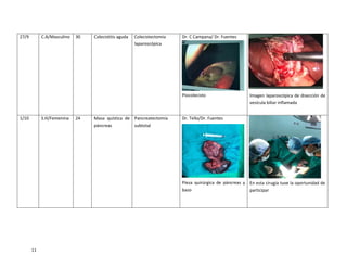 11
27/9 C.A/Masculino 30 Colecistitis aguda Colecistectomía
laparoscópica
Dr. C Campana/ Dr. Fuentes
Piocolecisto Imagen laparoscópica de disección de
vesícula biliar inflamada
1/10 S.H/Femenina 24 Masa quística de
páncreas
Pancreatectomía
subtotal
Dr. Tello/Dr. Fuentes
Pieza quirúrgica de páncreas y
bazo
En esta cirugía tuve la oportunidad de
participar
 