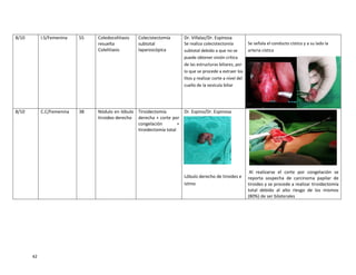 42
8/10 I.S/Femenina 55 Coledocolitiasis
resuelta
Colelitiasis
Colecistectomía
subtotal
laparoscópica
Dr. Villalaz/Dr. Espinosa
Se realiza colecistectomía
subtotal debido a que no se
puede obtener visión crítica
de las estructuras biliares, por
lo que se procede a extraer los
litos y realizar corte a nivel del
cuello de la vesícula biliar
Se señala el conducto cístico y a su lado la
arteria cística
8/10 C.C/Femenina 38 Nódulo en lóbulo
tiroideo derecho
Tiroidectomía
derecha + corte por
congelación +
tiroidectomía total
Dr. Espino/Dr. Espinosa
Lóbulo derecho de tiroides e
istmo
Al realizarse el corte por congelación se
reporta sospecha de carcinoma papilar de
tiroides y se procede a realizar tiroidectomía
total debido al alto riesgo de los mismos
(80%) de ser bilaterales
 