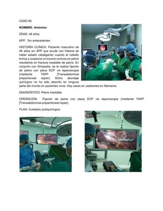 CASO #5
NOMBRE: Anónimo
EDAD: 46 años
APP: Sin antecedentes
HISTORIA CLÍNICA: Paciente masculino de
46 años sin APP que acude con historia de
haber estado cabalgando cuando el cabello
brinca y ocasiona un trauma contuso en pelvis
resultando en fractura inestable de pelvis. En
conjunto con Ortopedia, se le realiza fijación
de pelvis con placa DCP vis laparoscopia
(mediante TAPP [Transabdominal
preperitoneal repair). Dicho abordaje
quirúrgico no ha sido descrito en ninguna
parte del mundo en pacientes vivos. Hay casos en cadáveres en Alemania.
DIAGNÓSTICO: Pelvis inestable
OPERACIÓN: Fijación de pelvis con placa DCP vis laparoscopia (mediante TAPP
[Transabdominal preperitoneal repair).
PLAN: Cuidados postquirúrgico.
 