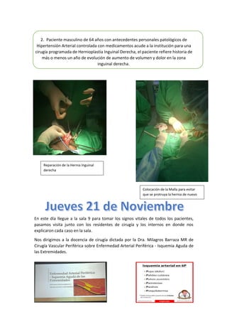 2. Paciente masculino de 64 años con antecedentes personales patológicos de
Hipertensión Arterial controlada con medicamentos acude a la institución para una
cirugía programada de Hernioplastia Inguinal Derecha, el paciente refiere historia de
más o menos un año de evolución de aumento de volumen y dolor en la zona
inguinal derecha.
En este día llegue a la sala 9 para tomar los signos vitales de todos los pacientes,
pasamos visita junto con los residentes de cirugía y los internos en donde nos
explicaron cada caso en la sala.
Nos dirigimos a la docencia de cirugía dictada por la Dra. Milagros Barraza MR de
Cirugía Vascular Periférica sobre Enfermedad Arterial Periférica - Isquemia Aguda de
las Extremidades.
Reparación de la Hernia Inguinal
derecha
Colocación de la Malla para evitar
que se protruya la hernia de nuevo
 