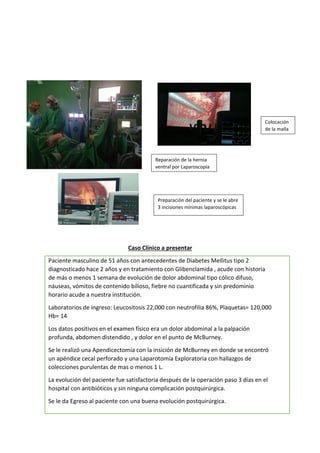 Caso Clínico a presentar
Paciente masculino de 51 años con antecedentes de Diabetes Mellitus tipo 2
diagnosticado hace 2 años y en tratamiento con Glibenclamida , acude con historia
de más o menos 1 semana de evolución de dolor abdominal tipo cólico difuso,
náuseas, vómitos de contenido bilioso, fiebre no cuantificada y sin predominio
horario acude a nuestra institución.
Laboratorios de ingreso: Leucositosis 22,000 con neutrofilia 86%, Plaquetas= 120,000
Hb= 14
Los datos positivos en el examen físico era un dolor abdominal a la palpación
profunda, abdomen distendido , y dolor en el punto de McBurney.
Se le realizó una Apendicectomía con la insición de McBurney en donde se encontró
un apéndice cecal perforado y una Laparotomía Exploratoria con hallazgos de
colecciones purulentas de mas o menos 1 L.
La evolución del paciente fue satisfactoria después de la operación paso 3 días en el
hospital con antibióticos y sin ninguna complicación postquirúrgica.
Se le da Egreso al paciente con una buena evolución postquirúrgica.
Preparación del paciente y se le abre
3 incisiones mínimas laparoscópicas
Reparación de la hernia
ventral por Laparoscopía
Colocación
de la malla
 