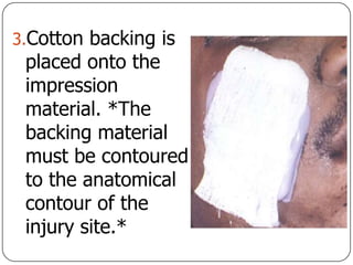 3.Cotton backing is
placed onto the
impression
material. *The
backing material
must be contoured
to the anatomical
contour of the
injury site.*
 