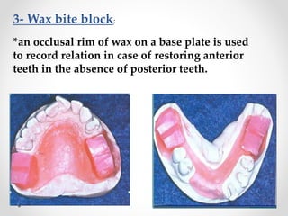 bite registeration.pptx