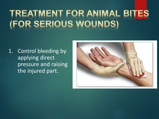1. Control bleeding by
applying direct
pressure and raising
the injured part.
 