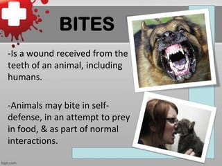 BITES
-Is a wound received from the
teeth of an animal, including
humans.
-Animals may bite in selfdefense, in an attempt to prey
in food, & as part of normal
interactions.

 