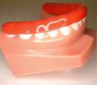 Glauser-Williams Orthodontics - Bitesplint