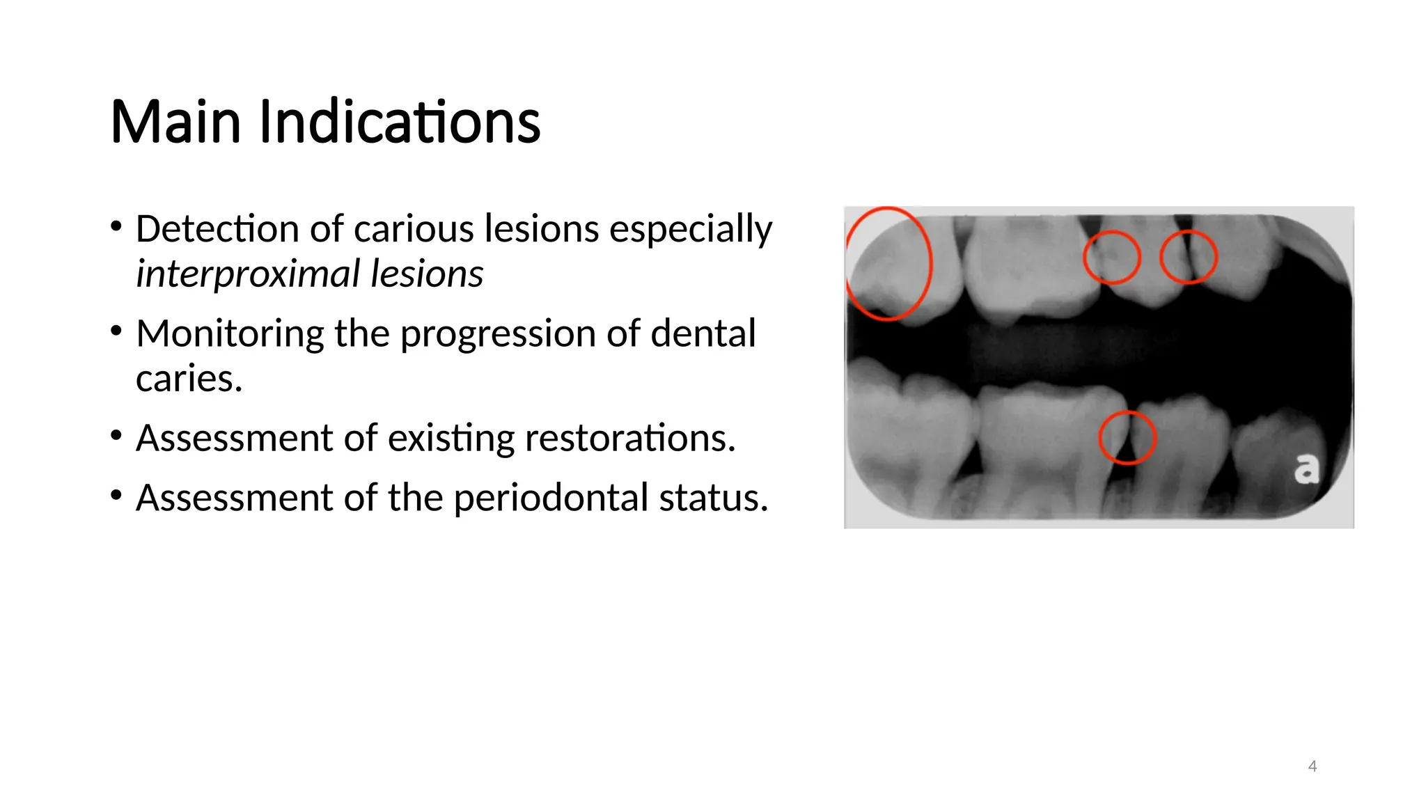 Bitewing Radiography Pdf Bitewing and Occlusal radiography .pptx