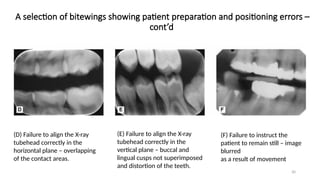 Bitewing and Occlusal radiography .pptx