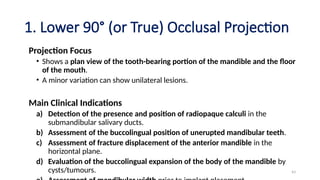 Bitewing Radiography Slide Bitewing and Occlusal radiography .pptx