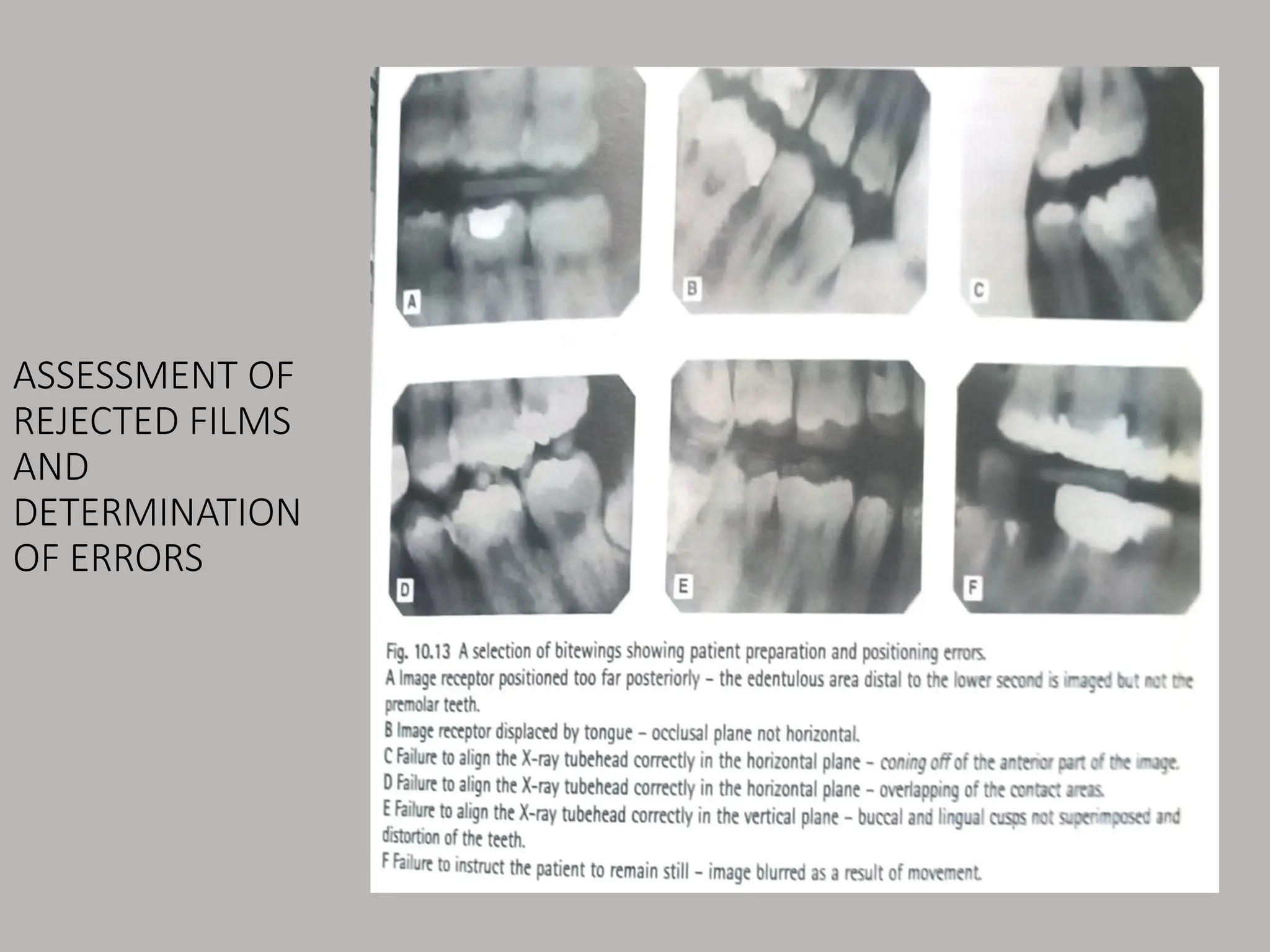 ASSESSMENT OF
REJECTED FILMS
AND
DETERMINATION
OF ERRORS
 