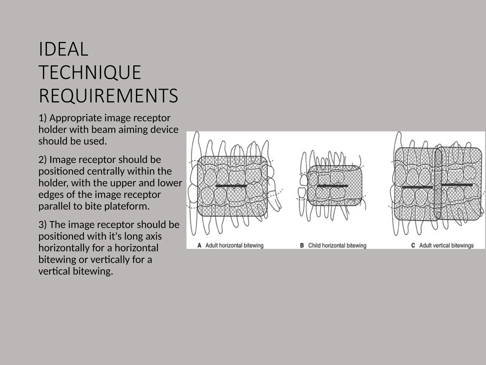 IDEAL
TECHNIQUE
REQUIREMENTS
1) Appropriate image receptor
holder with beam aiming device
should be used.
2) Image receptor should be
positioned centrally within the
holder, with the upper and lower
edges of the image receptor
parallel to bite plateform.
3) The image receptor should be
positioned with it's long axis
horizontally for a horizontal
bitewing or vertically for a
vertical bitewing.
 